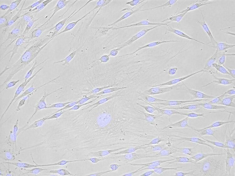 Primary Dermal Fibroblasts for Research